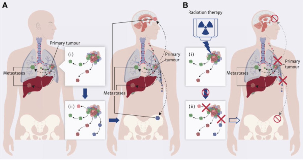 Stephen V Liu, MD tweet media