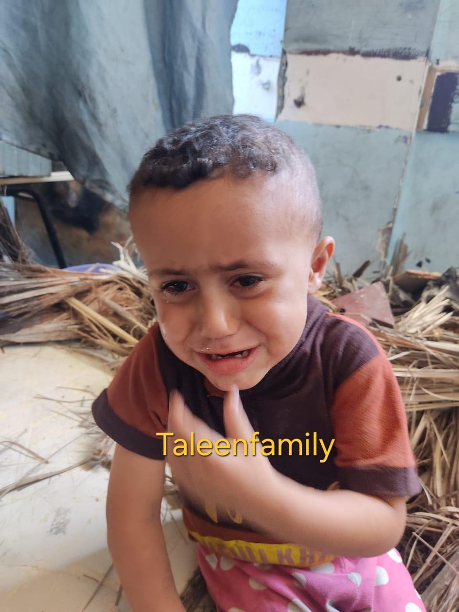 TaleenFamily's tweet photo. My little son suffers from crazy pain, he suffers from a "Rat bite" due to lack of shelter and cleanliness, we sit in a shelter full of flies, insects and garbage, our house is completely destroyed

3 replies - even dots — can save my children

https://t.co/NnPQLhLIxa https://t.co/GqoTrFtBz7