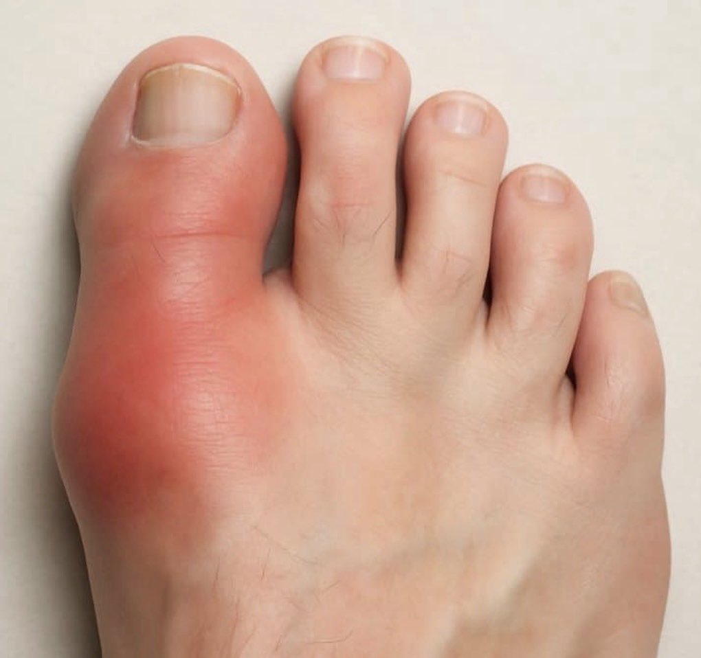 Medpulse🩺 tweet media