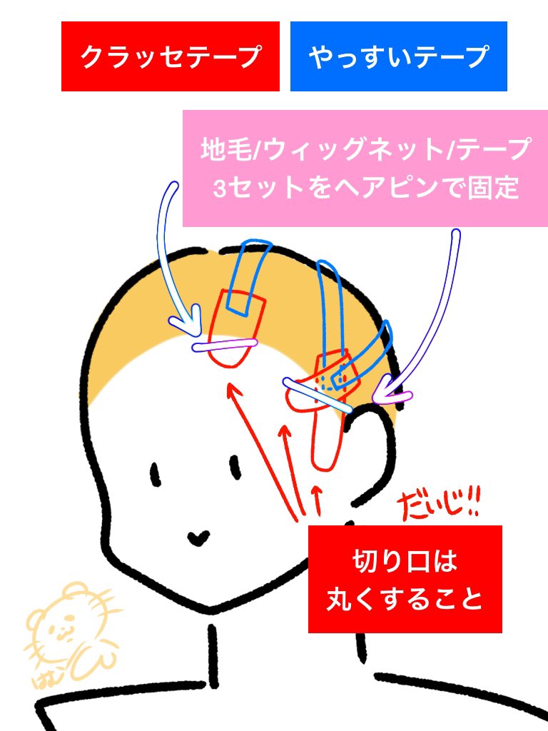 え、このいいねはどういう意味w

購入しているテーピングは
「クラッセ 顔すっきりテープ」の3個入
割高に見えるけど、顔と少しウィッグネットに乗る程度の量を使って『本格的に引っ張る用』のテープはやっすい百均のヤツ使ってます。お肌だけ守れればそれでいいのでね🤟
切り口丸くするのも大事よ🫵