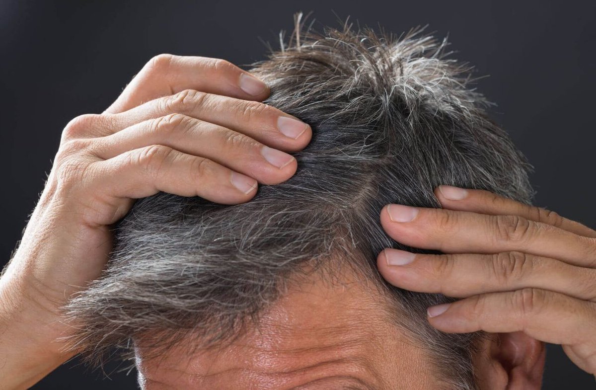 Dheeru ❤ tweet media