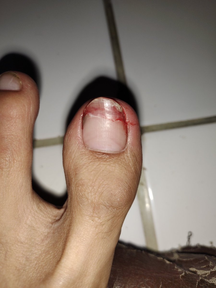 girAffe🦒 tweet media