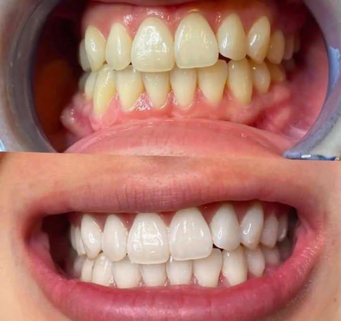 ملاك tweet media