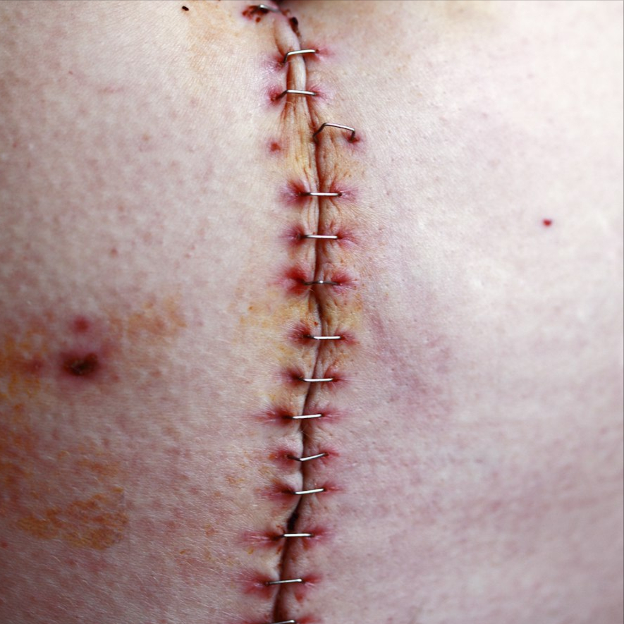 TodoDermatitis tweet media