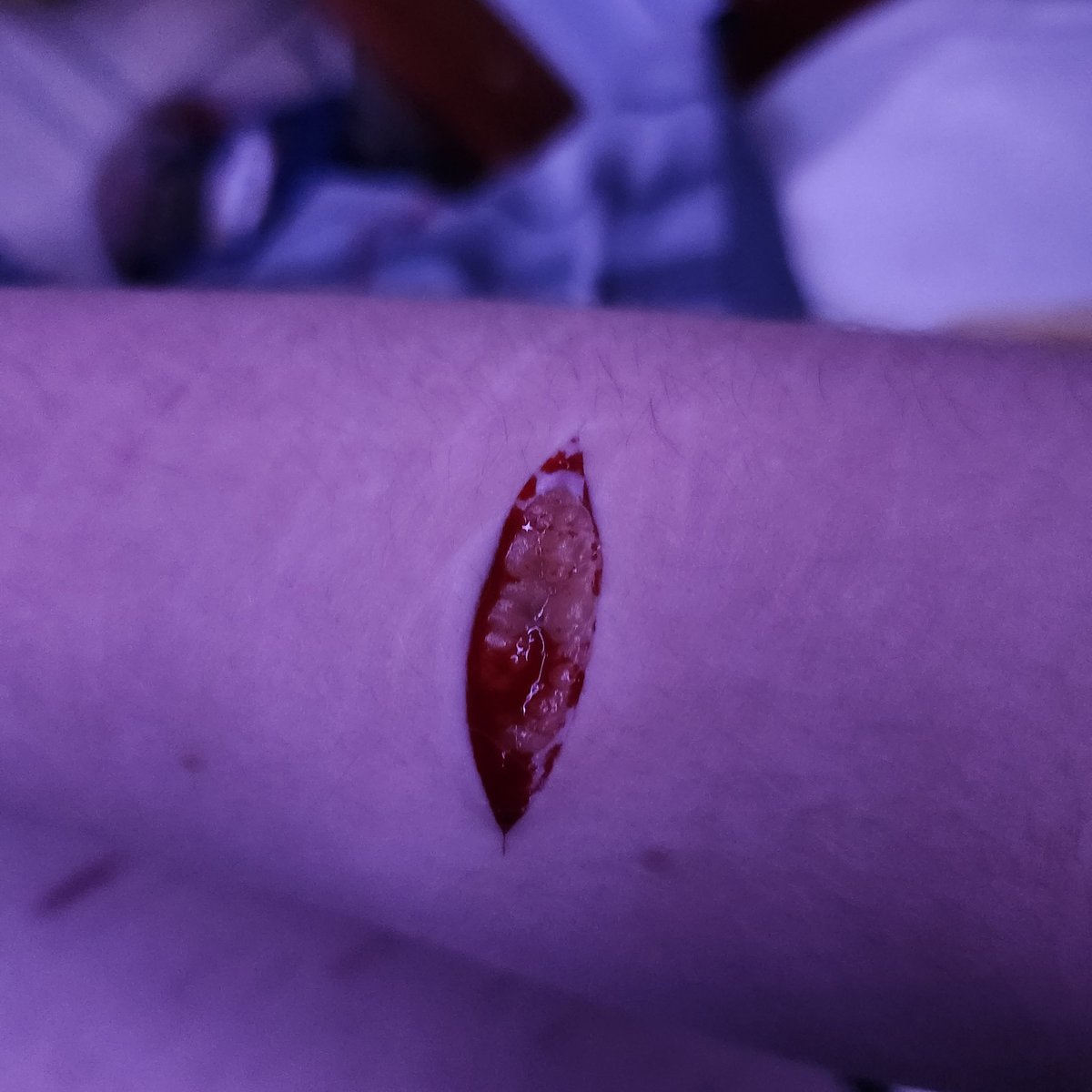 jay_da1forher's tweet photo. Two week difference with proper care #shtwt #slittwt #beanstwt https://t.co/RdKFsP9l57