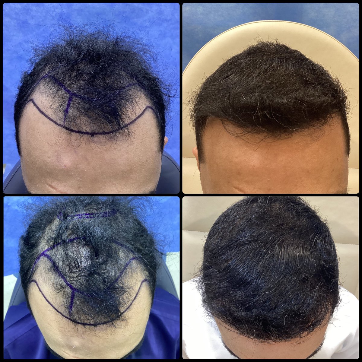 Dr. Abdullah AlBarrak د. عبدالله البراك tweet media