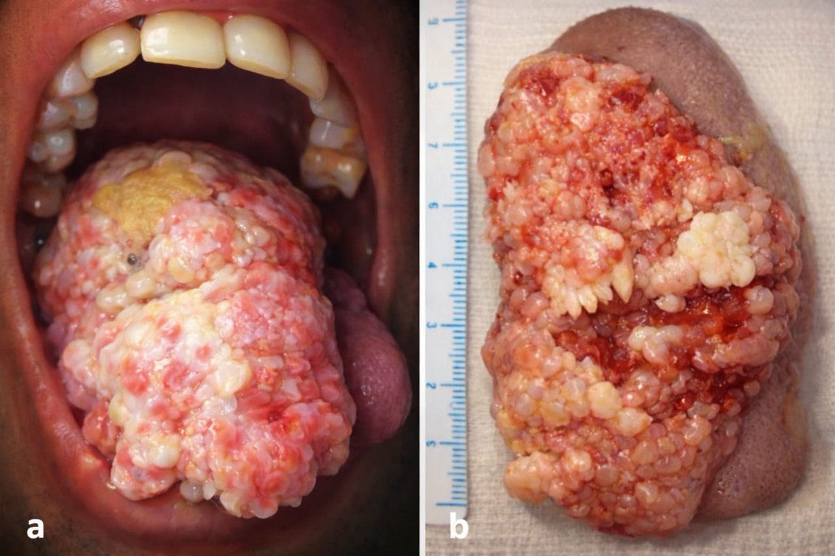 Dr Ihab Suliman tweet media