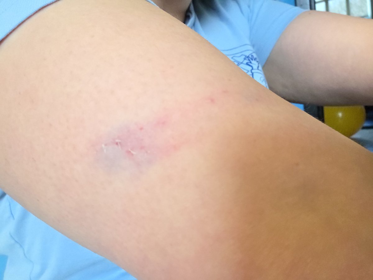 If a child can't hear the word "no", we are creating a society of temper tantrums. "No" is a part of life. When a teacher/ EA/CYC says no to a kid they should absolutely not be attacked. The child should learn to hear no. Enough is enough.