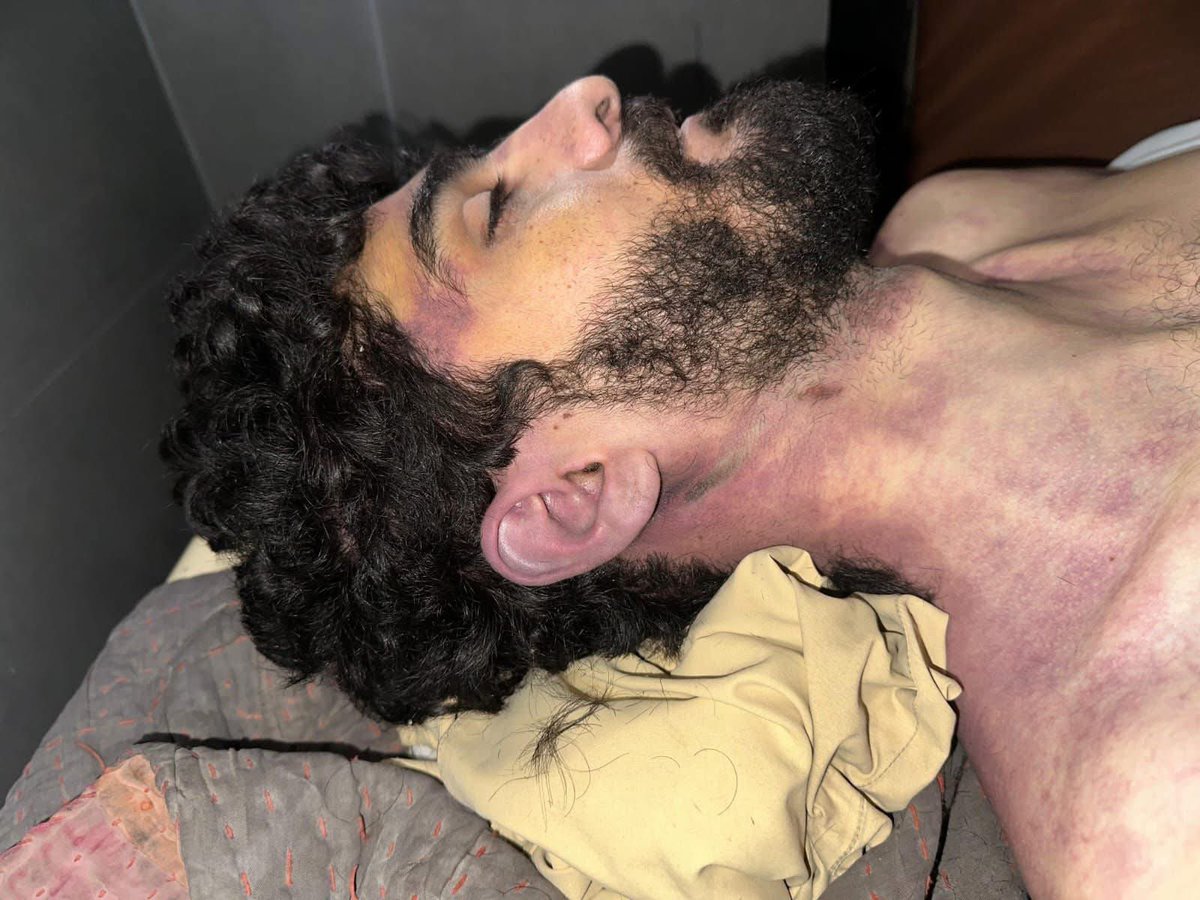 Strongly condemn the extrajudicial killing of Israr Qalandarani in Quetta. He was reportedly kept in illegal detention for six days after being arrested by police, and later his dead body was handed over to the family. The provincial government must take immediate action and