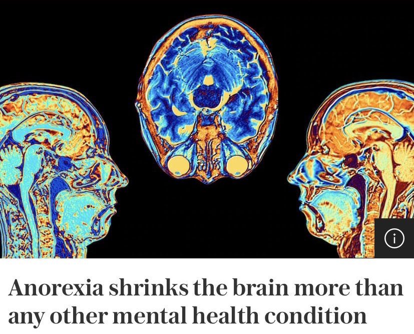 dontcrysaanjh's tweet image. every single day i read at least five tweets on edtwt that prove this study inadvertently