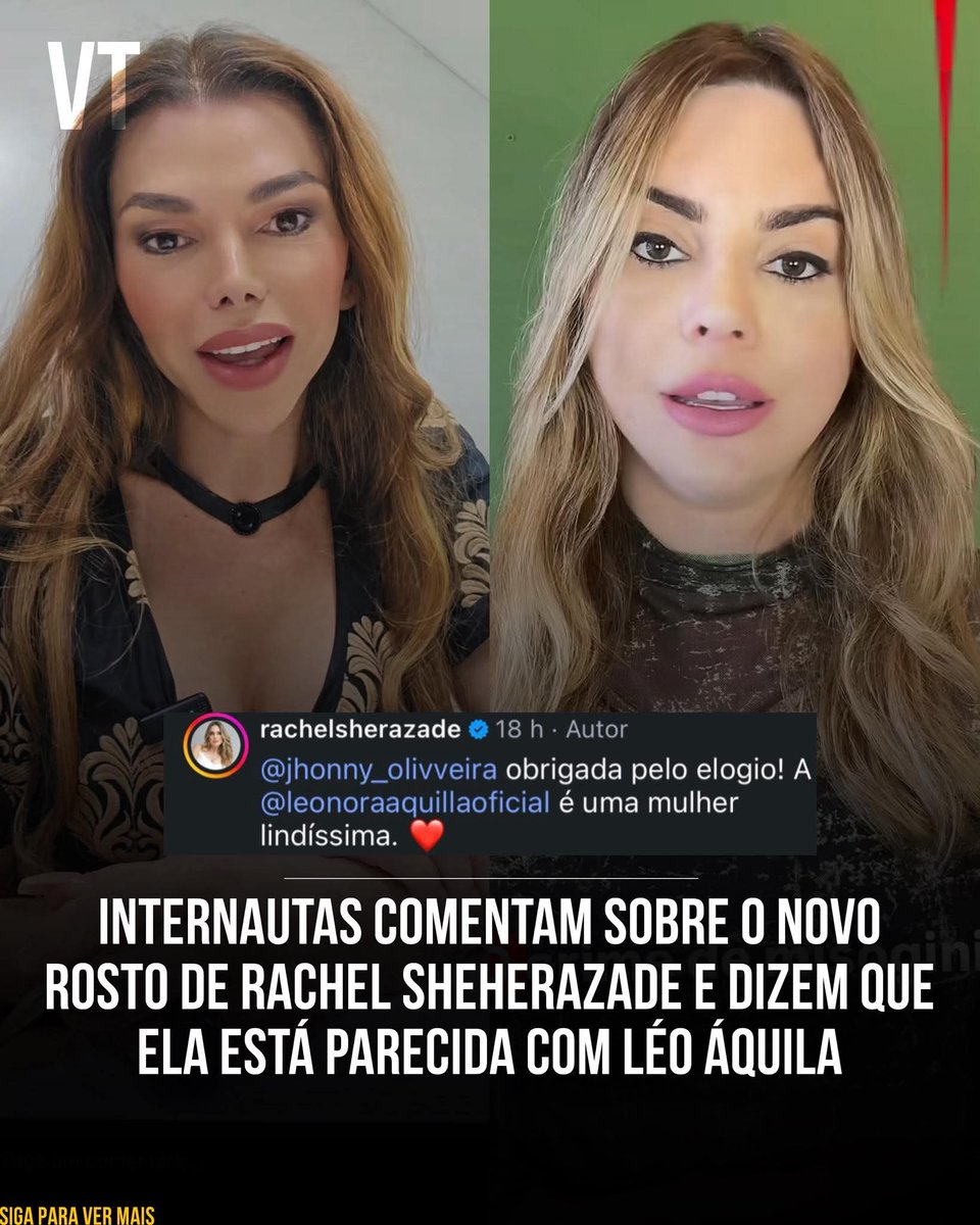 Eltonjs ₿ tweet media