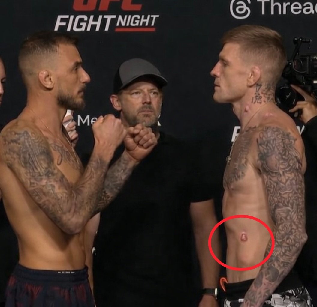 Renato Money Acriano tweet media