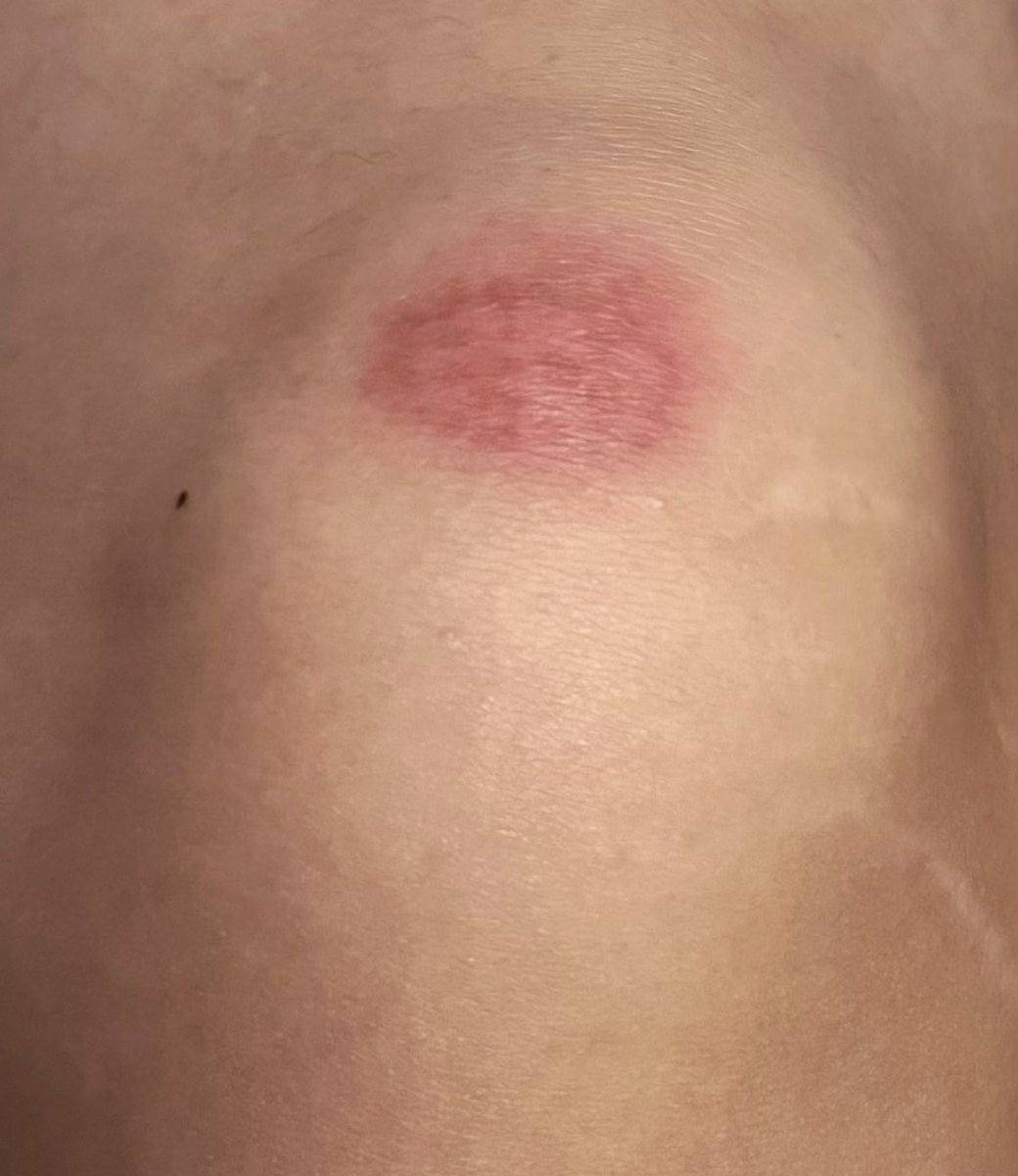 悲伤的前妻 tweet media