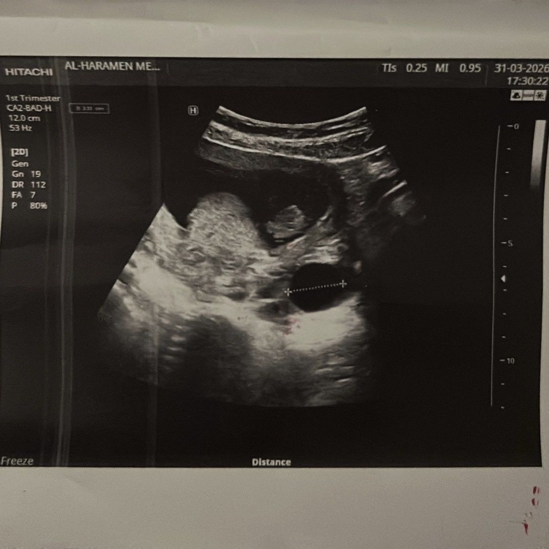 متصدر لاتكلمني | NORA tweet media