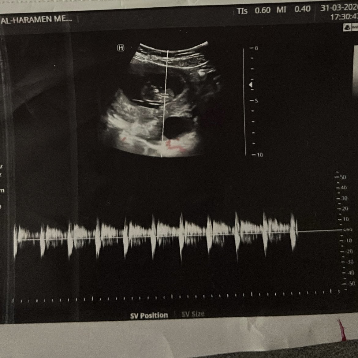 متصدر لاتكلمني | NORA tweet media