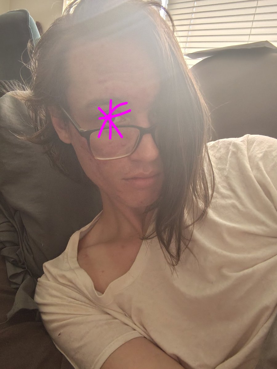 Wyld_Switch tweet media