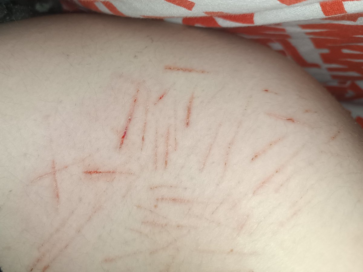 🏳️⚧️✭𝙼𝚊𝚝𝚝𝚢✭🇸🇰 tweet media