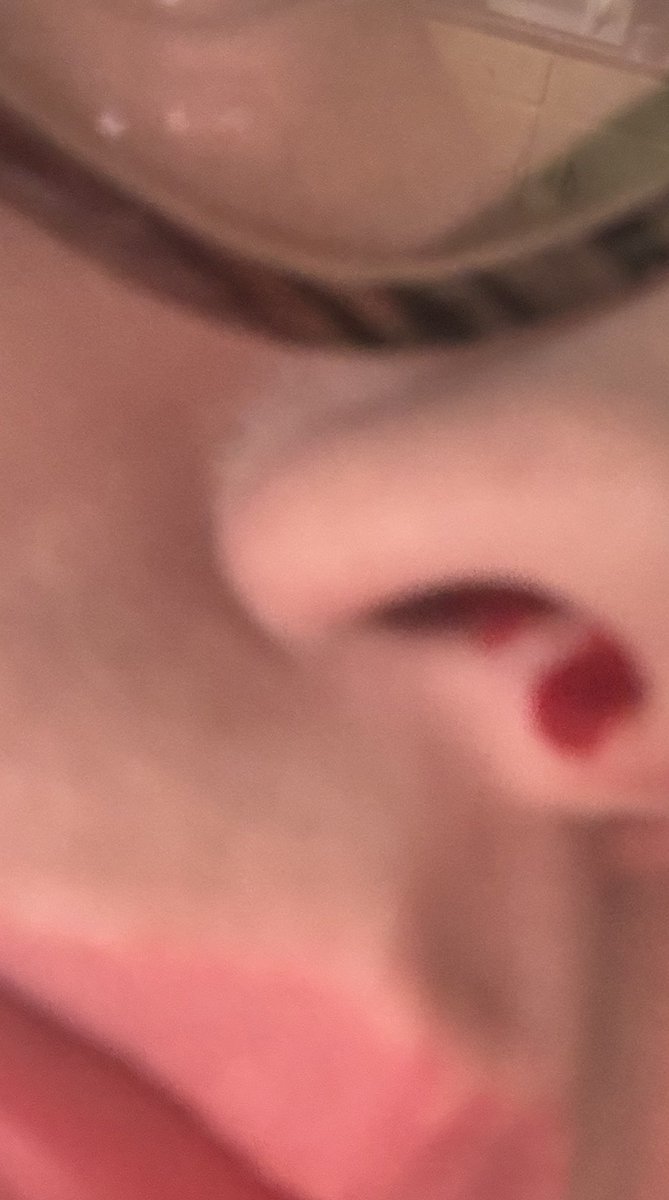 spawn -💤 tweet media