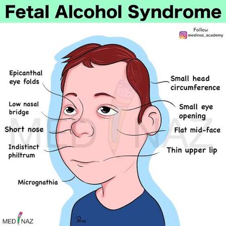 無敵 光線 尊厳 tweet media