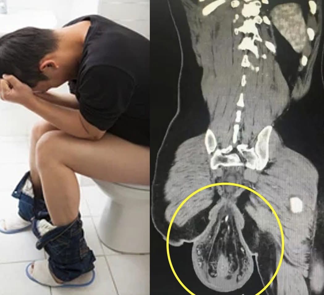 Mr PitBull tweet media