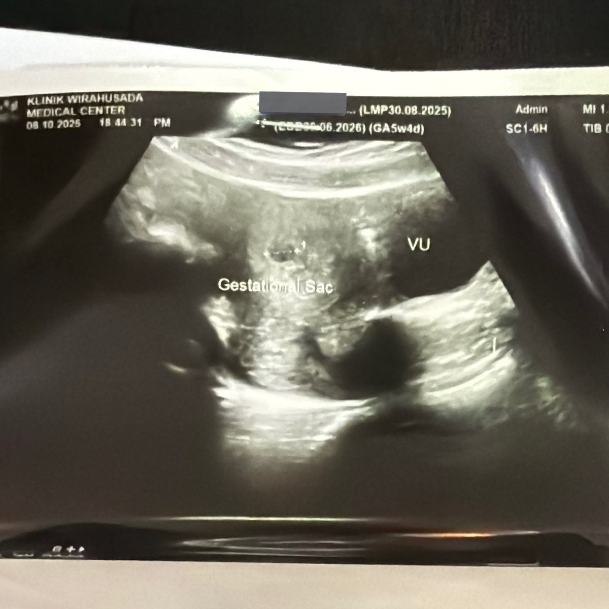 🇮🇩🇦🇺 tweet media