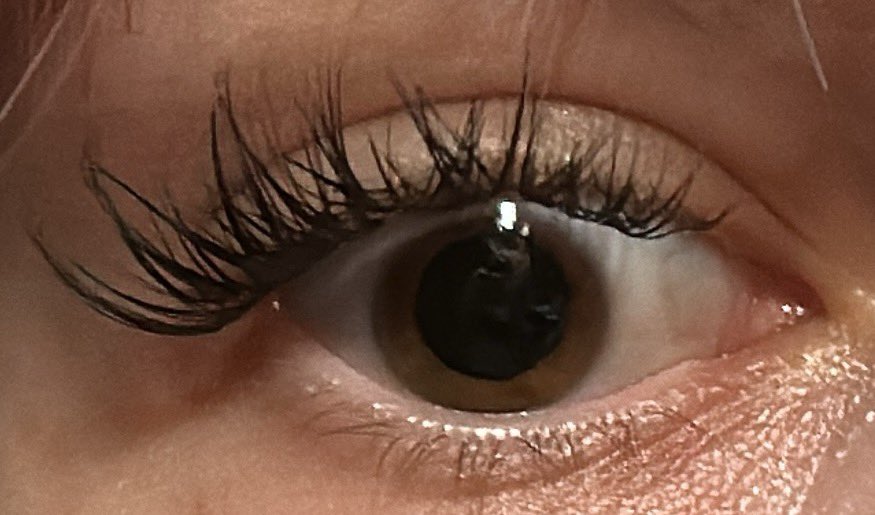 Annica piwnica 💎🦷 tweet media