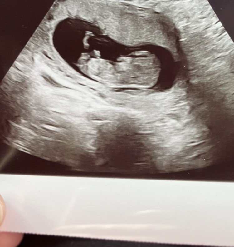 Hypernaut tweet media