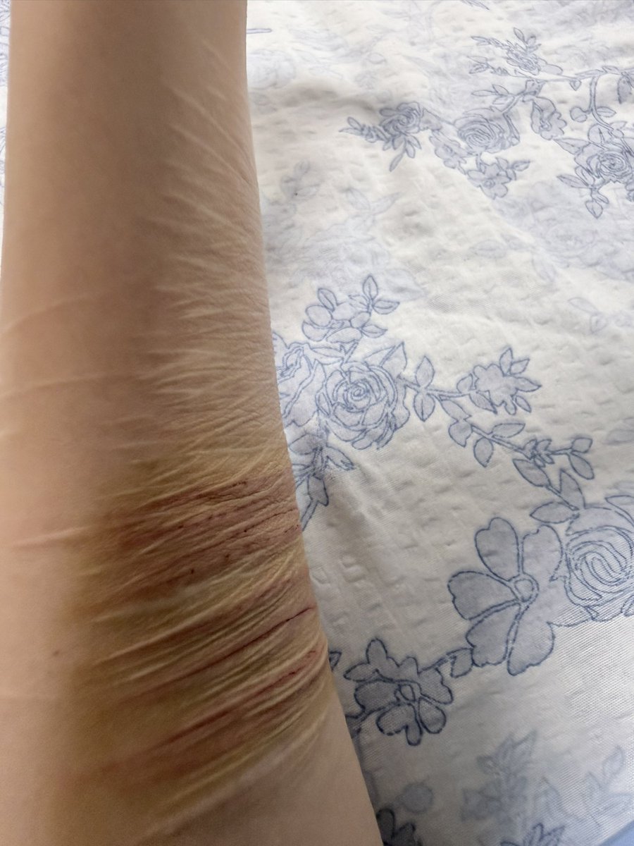 诅咒是纯白色 tweet media