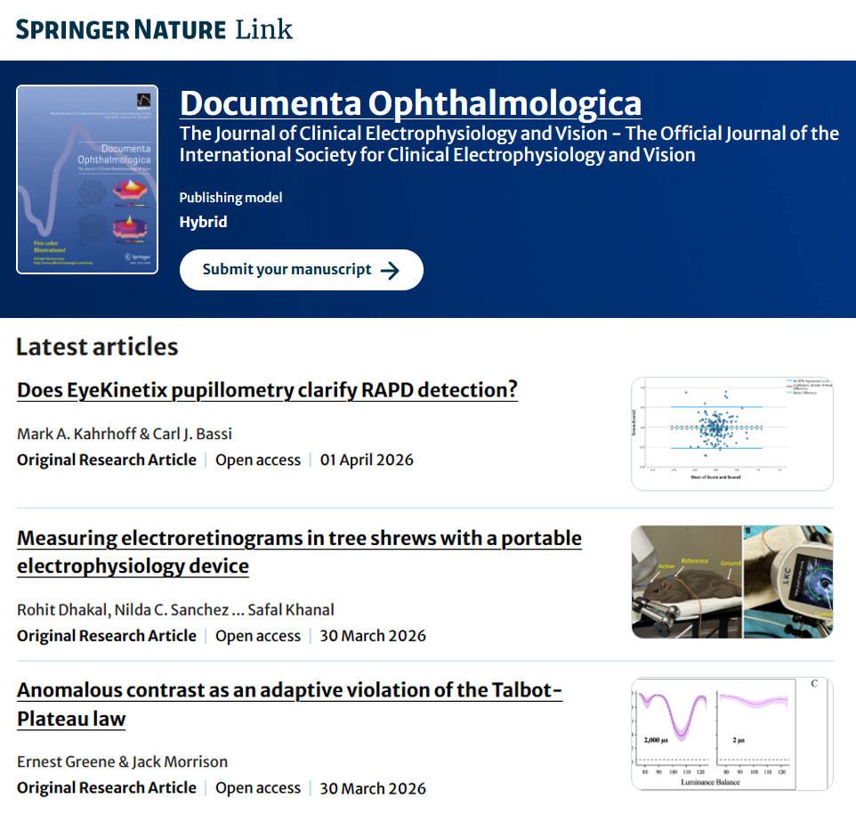iscev_org's tweet photo. As you keep up with the literature, don’t forget to check out the latest articles featured on the @SpringerNature  Documenta Ophthalmologica website. https://t.co/uSD5Dj4WI6