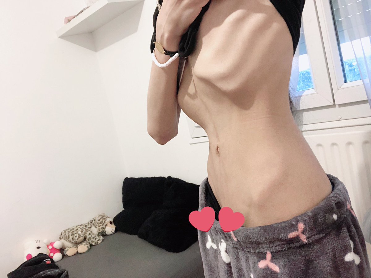 ່wonyette ୨ৎ bmi 13 jail tweet media