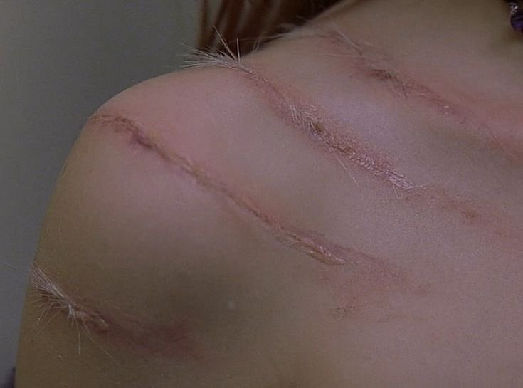 icumglitterglue's tweet photo. How does Pinterest see you? 
#shtwt version 
- Bandage 
- Blood 
- Razor blade
- Scars https://t.co/1G1NYNDjhU