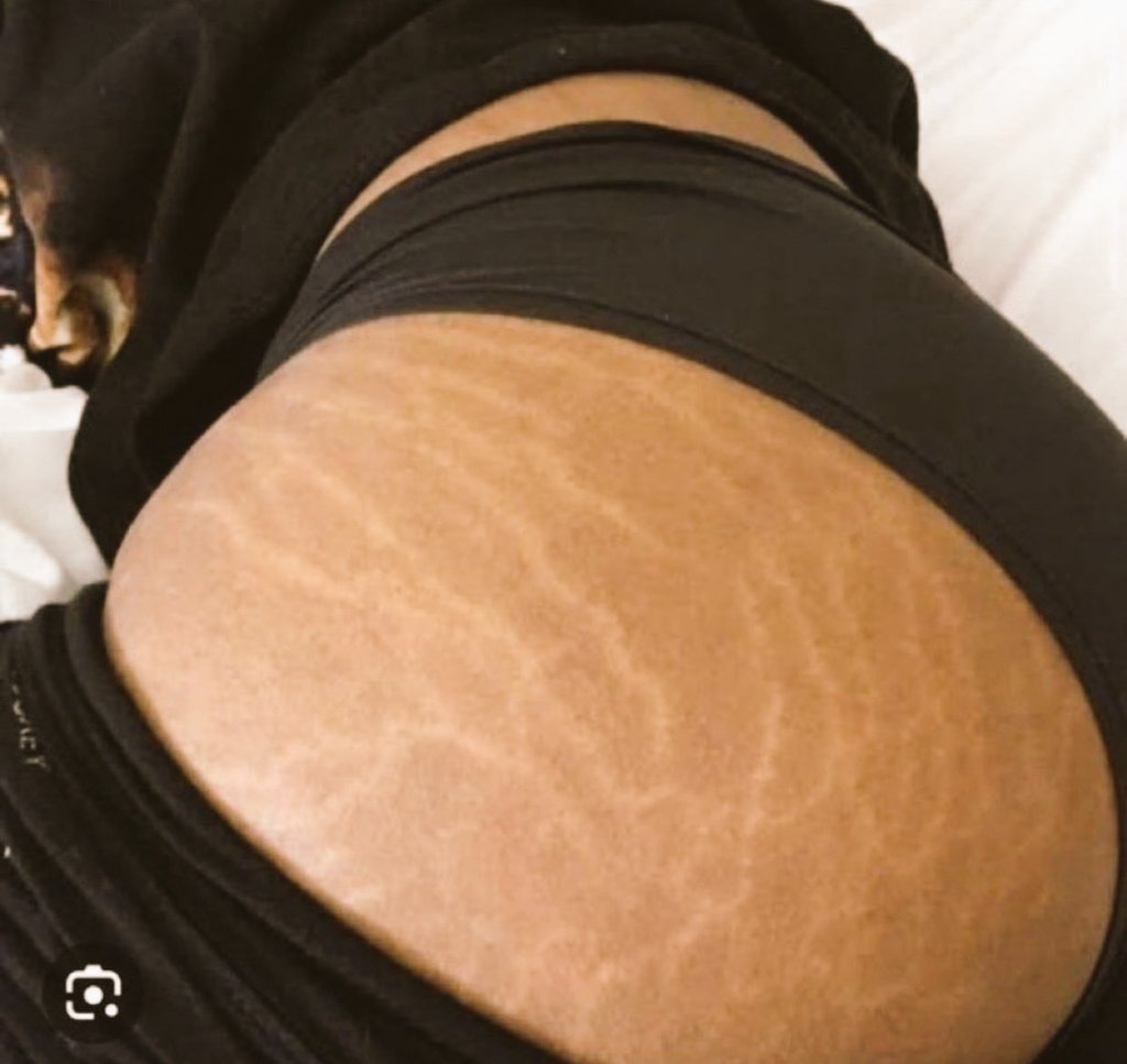 Tòmíwáá💙🎶 tweet media