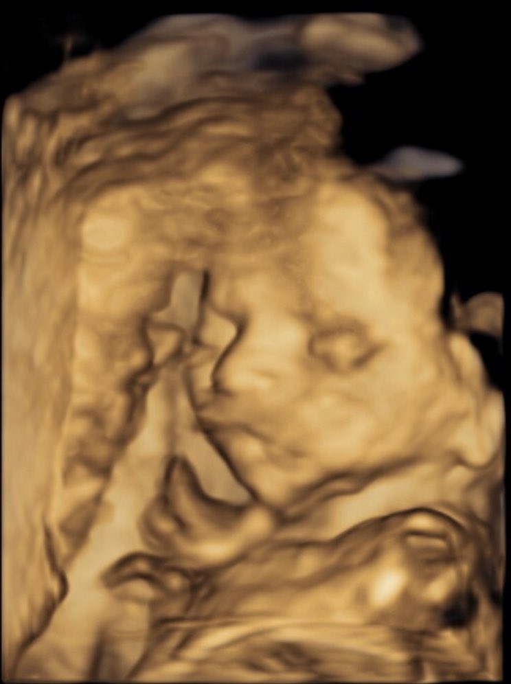 Erica Satin tweet media