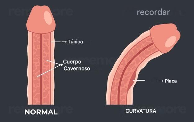 Felipe CarrilloX tweet media