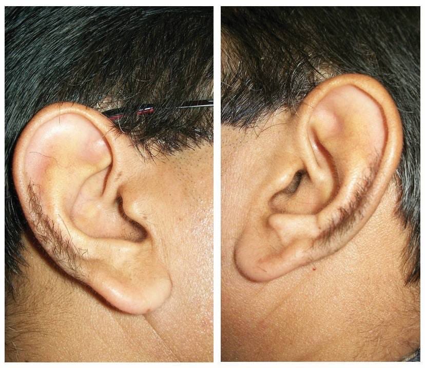 سعد الغنامي tweet media