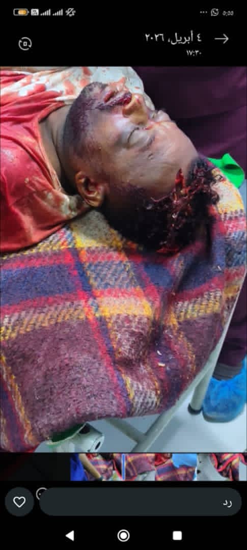 Amin Al-Bakri البكري tweet media