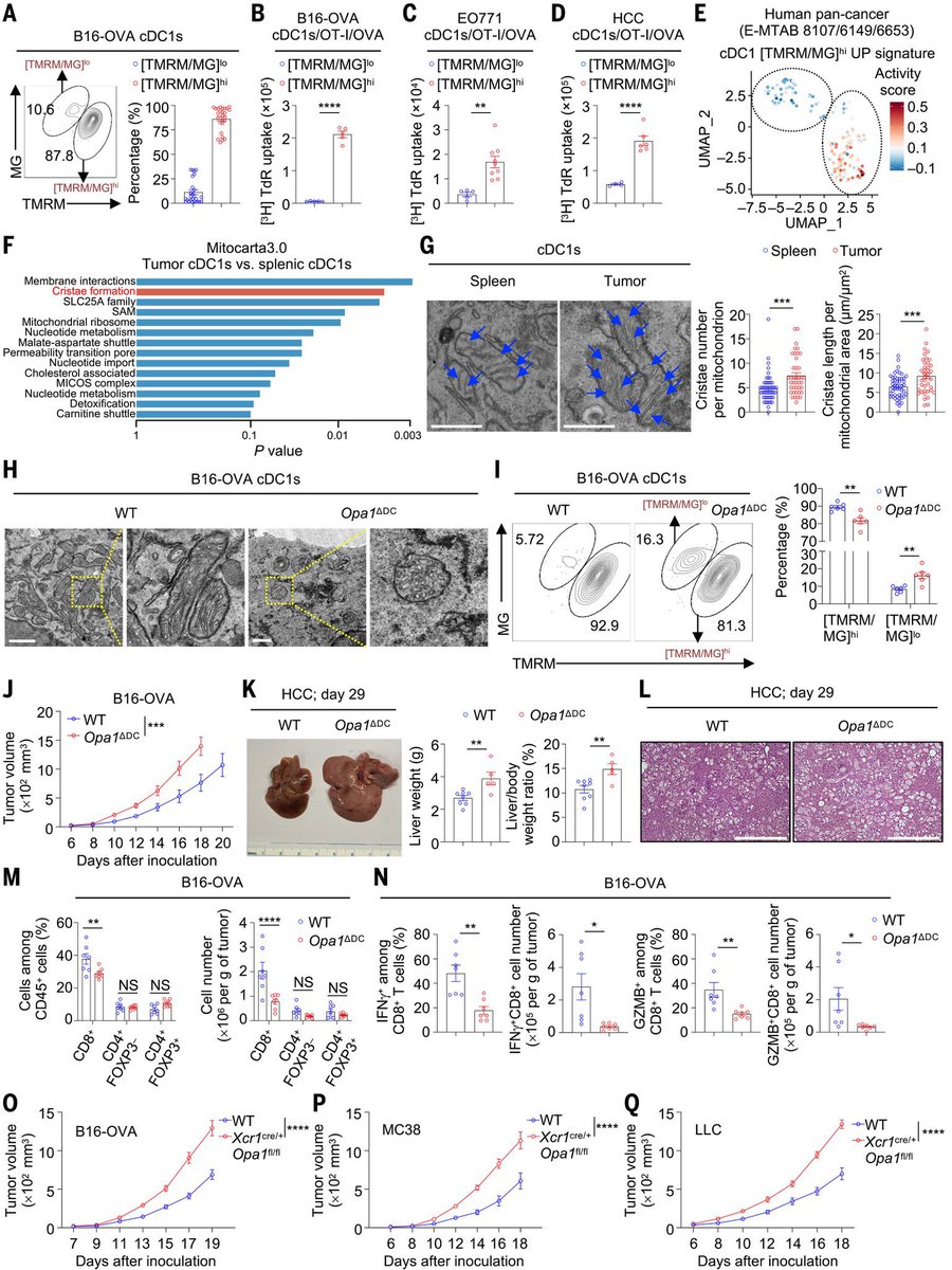 PatrickHwuMD's tweet photo. ๐งฌ #ScienceSaturday
โ What if the โenergy stateโ of an immune cell determines how well it can fight cancer?
โก๏ธ In a new study published in @ScienceMagazine, researchers found that dendritic cells inside tumors exist in two mitochondrial states, and only the โhigh-energyโ cells effectively activate CD8+ T cells.
โก๏ธ These high-functioning cells rely on the OPA1โNRF1 pathway to sustain mitochondrial metabolism and preserve antigen presentation.
โก๏ธ When this pathway breaks down, antigen presentation drops and anti-tumor immune responses weaken.
๐ Reprogramming immune cell metabolism could help strengthen immunotherapy responses and overcome treatment resistance.
๐ Read the study: https://t.co/kiHMMoFmRt
@hongbo_chi @StJude