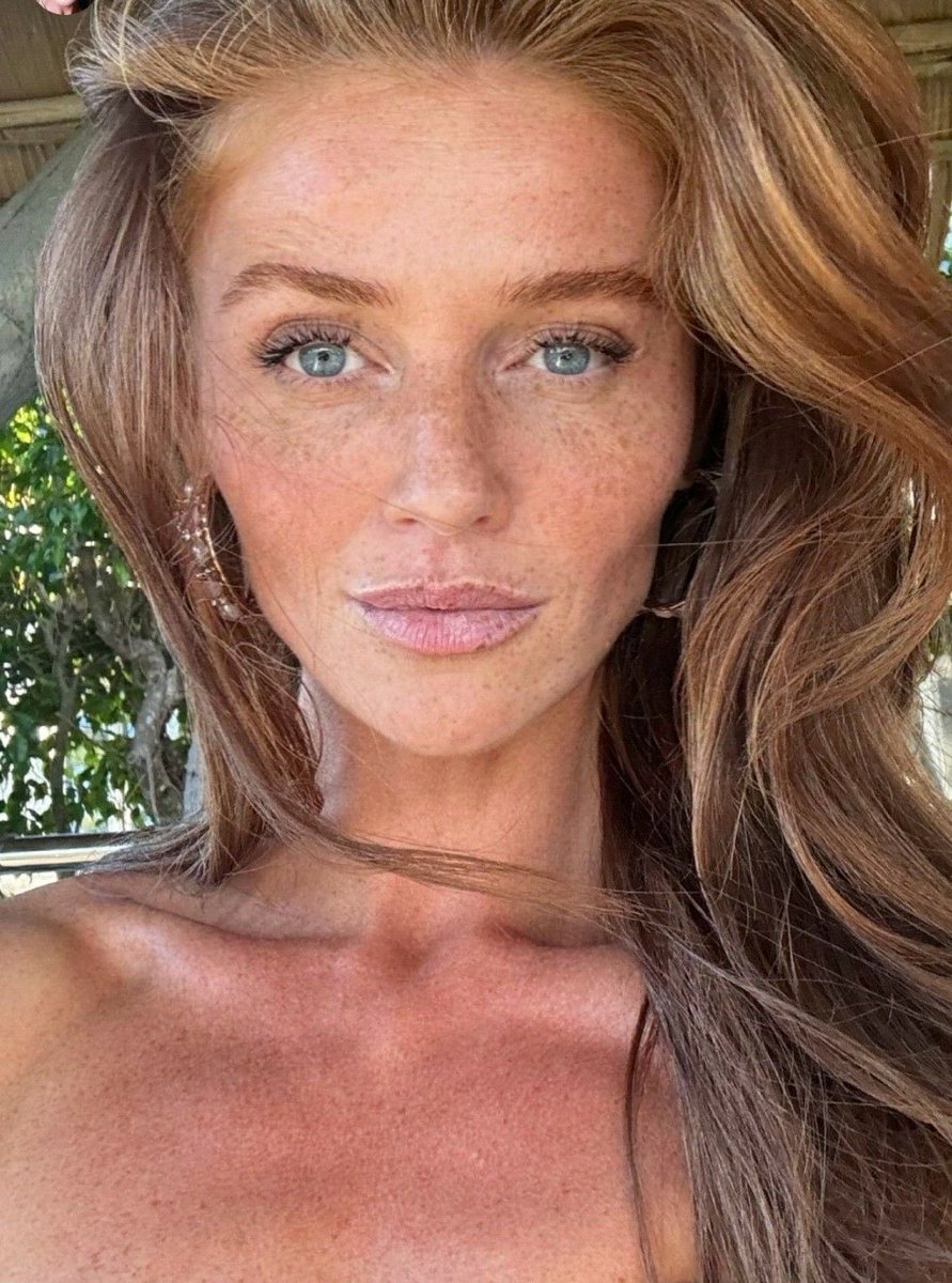 FreckledFace🧡 tweet media