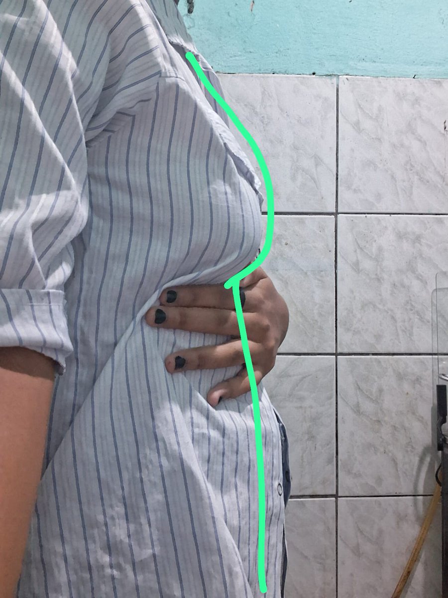 louis⁷ knuckles de calcinha tweet media