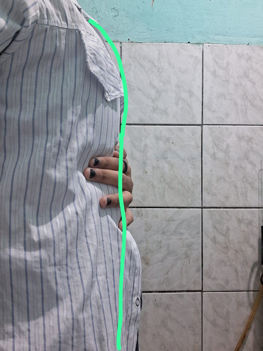 louis⁷ knuckles de calcinha tweet media