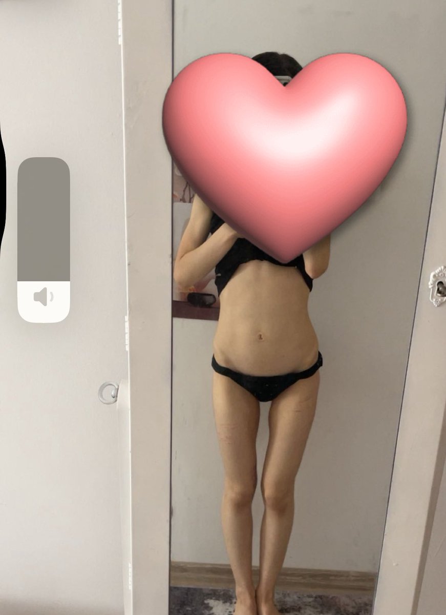 ★彡 𝐚cţᎥѶⒺℓⓨ d𝕪𝓲ᶰ𝕘 彡★ 𝓈н𝒆𝓭Ŧ𝐖𝔱 tweet media