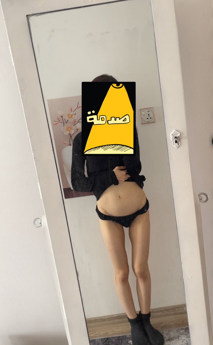 ★彡 𝐚cţᎥѶⒺℓⓨ d𝕪𝓲ᶰ𝕘 彡★ 𝓈н𝒆𝓭Ŧ𝐖𝔱 tweet media