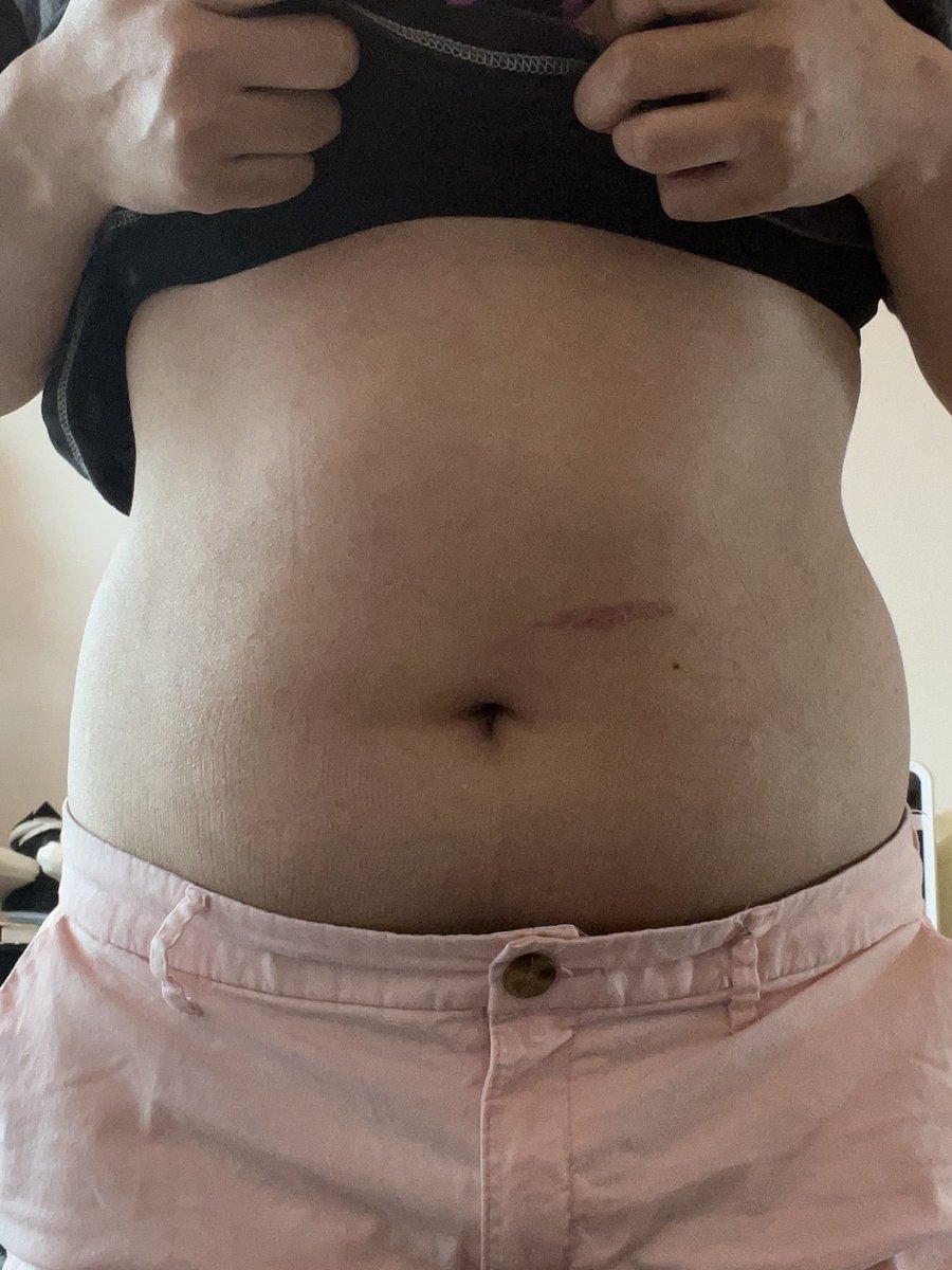 disordereddoggy's tweet photo. Ugh so fat #bodycheck https://t.co/HPM0iwTVif