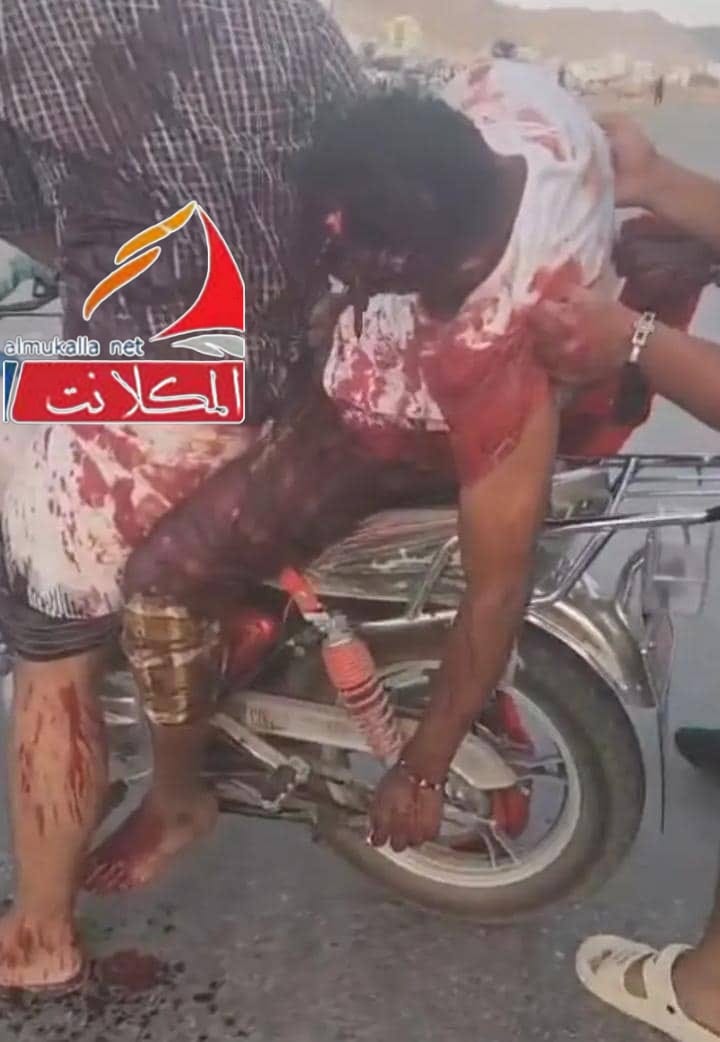 AdenWedad's tweet photo. عندما تكالبت قوى الشر، أفرغت مكنون حقدها وضغينتها ضد الجنوب وتجاه المتظاهرين السلميين اليوم في المكلا https://t.co/NXhXtY4BLu