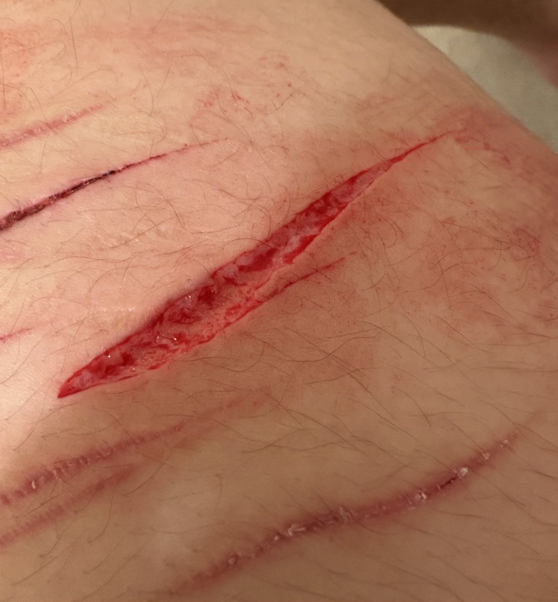 .𖥔 ݁ ˖╭ Kσԋαɳҽ σϝ ʂԋƚɯƚ ╰ attempting recovery! tweet media