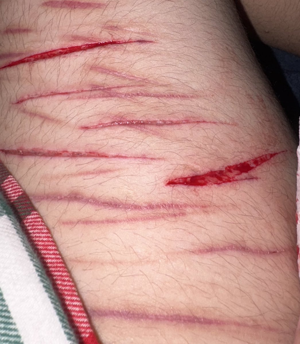 .𖥔 ݁ ˖╭ Kσԋαɳҽ σϝ ʂԋƚɯƚ ╰ attempting recovery! tweet media