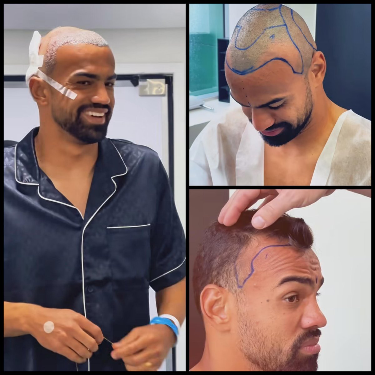 Fabricio Lopes tweet media