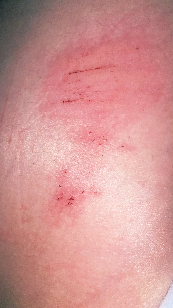 ⏤͟͟͞͞ପlíxíҽsհԵաԵও彡 tweet media