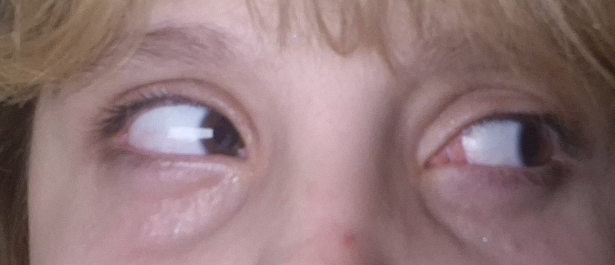 stretched john tweet media