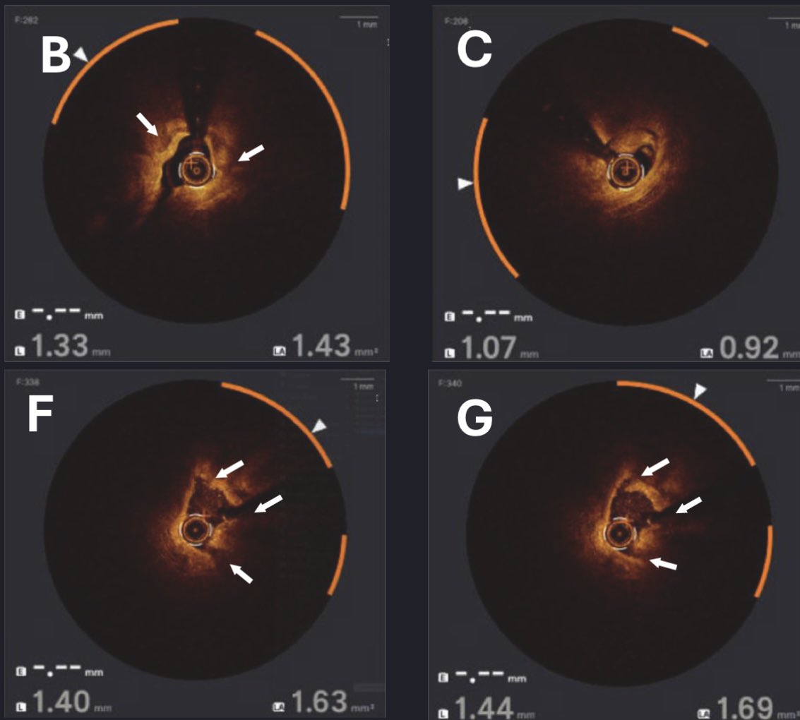 Salman Arain tweet media